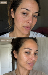 Bioactive Prebiotics Jelly Serum