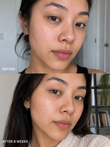 Niacinamide Balancing Gel Moisturiser