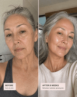 AHA Renewal Serum - barely skin