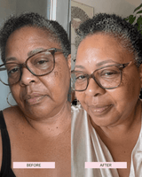 CBD Skin Renewal Oil - barely skin