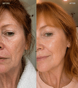 Ceramide Barrier Night Repair Cream - barely skin