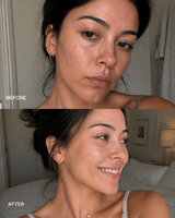 Double HA Hydration Boost Gel - barely skin