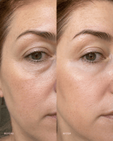 Hyaluronic Smoothing Eye Cream - barely skin