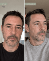 Iceland Moss & Hyaluronic Acid Moisturiser - barely skin