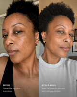Pigment Correcting Serum - barely skin