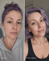 Radiant Glow Facial Wash - barely skin