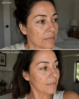 Retinol Alternative Moisturiser - barely skin