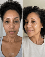 Sensitive Skin Moisturiser - barely skin