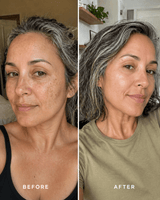 Targeted Dark Spot Care, 1% Kojic Acid - barely skin