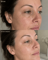 The PM Routine - barely skin