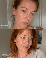 Vitamin C Serum - barely skin