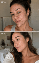 Volcano Face & Body Scrub - barely skin